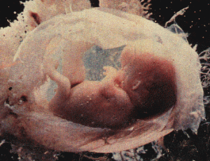 foetus-4mois-gif